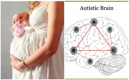 Причина аутизма - в матери: Гормон плаценты может привести к отклонению – медики - «Новости»