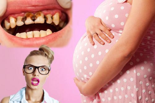 Кариес во время беременности может привести к преждевременным родам - «Новости»