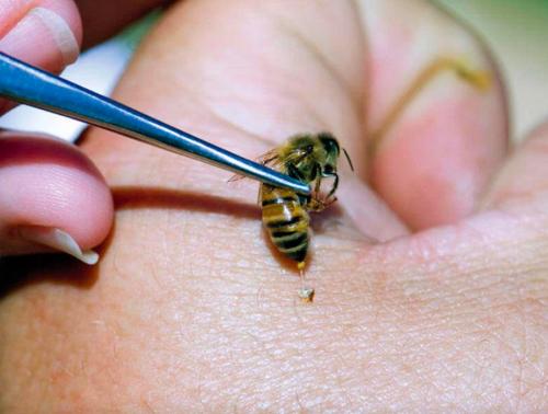 Красота требует жертв: Укусы пчёл способствуют похудению - «Наука»