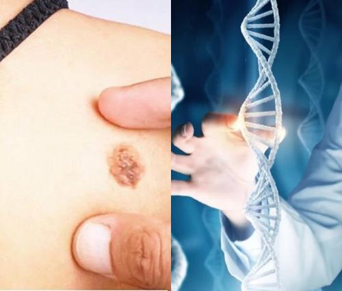 Найден белок, связанный с геном рака кожи - «Новости»