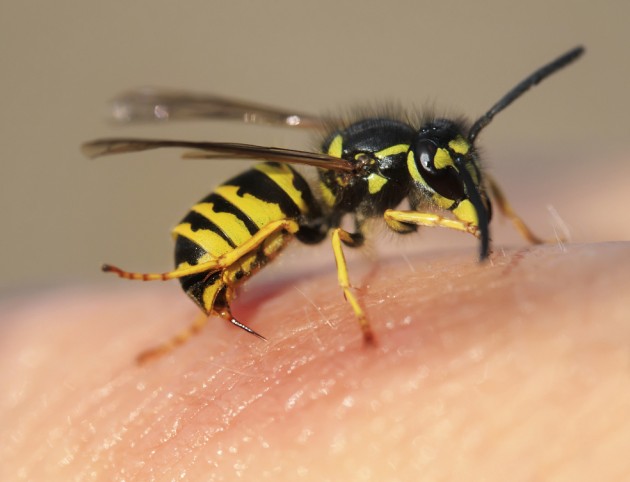 Что делать, если ужалила пчела или оса? Советы аллерголога